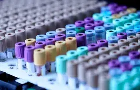Colour-coded specimen tubes prepared for laboratory analysis
